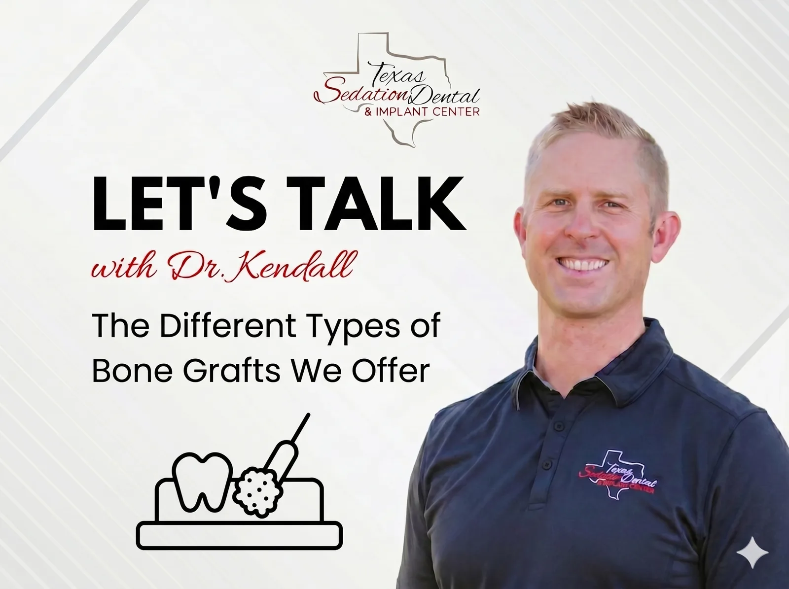 Types of Dental Bone Grafts and Why We Do Them Before Implants