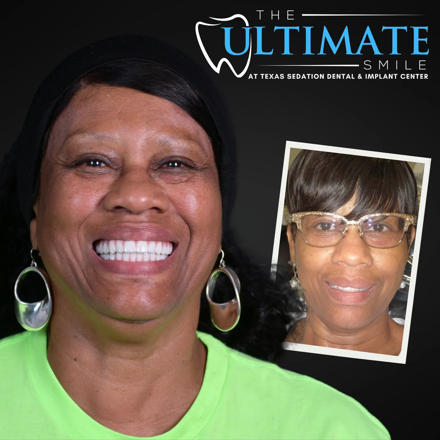 Patient before and after smile transformation