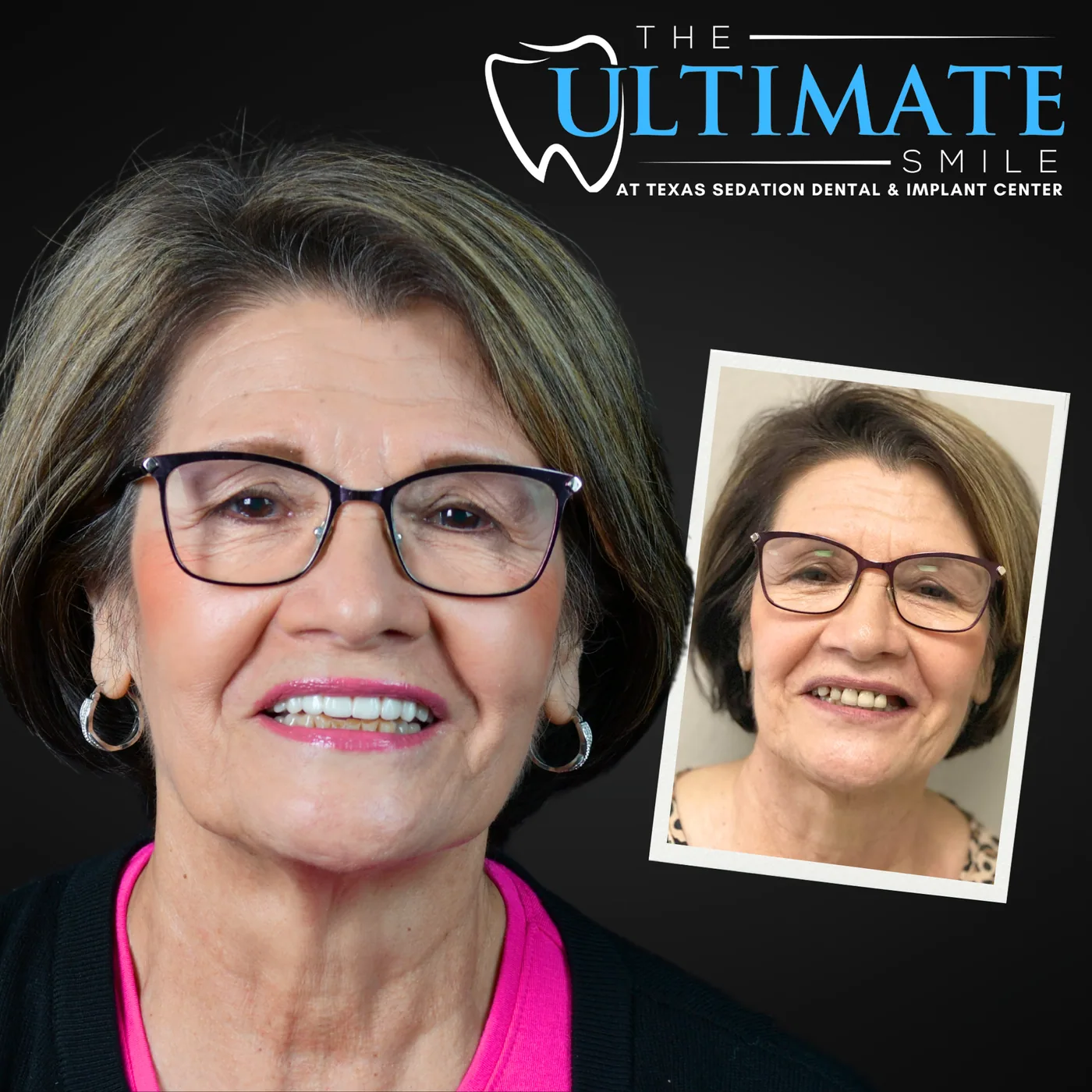 Patient before and after smile transformation