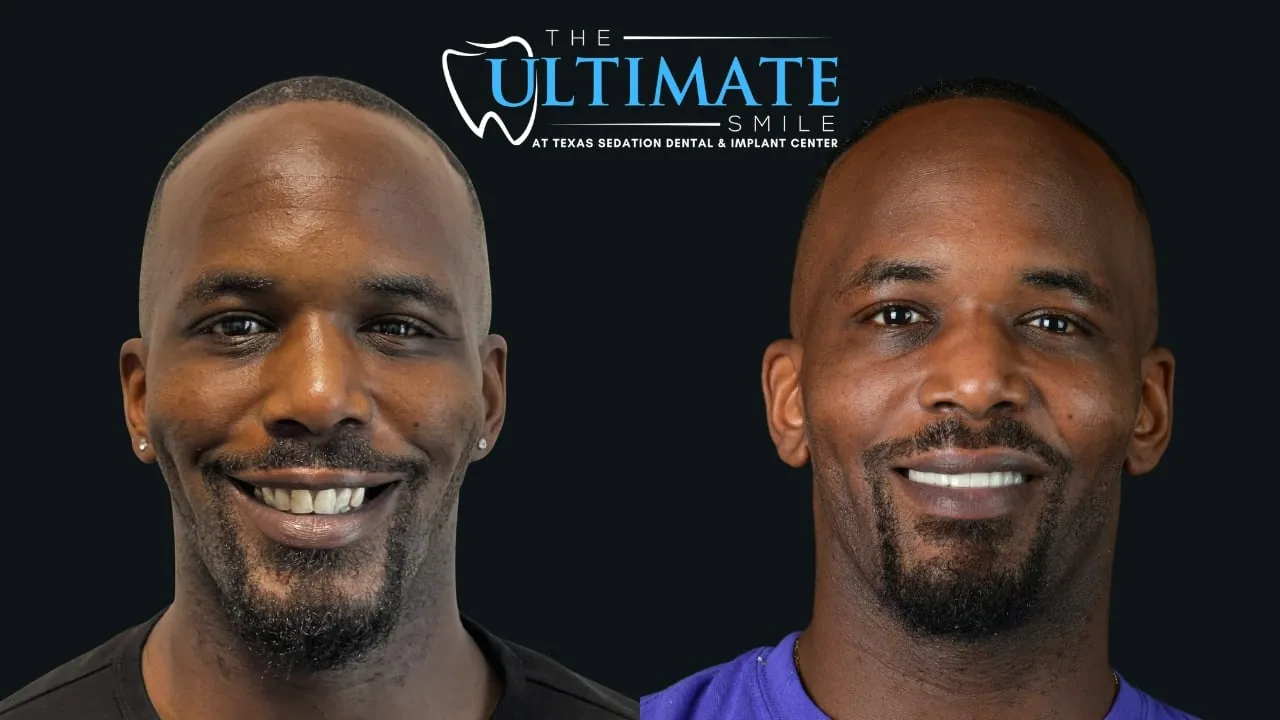 Real Texas Sedation Dental patient, before and after smile transformation