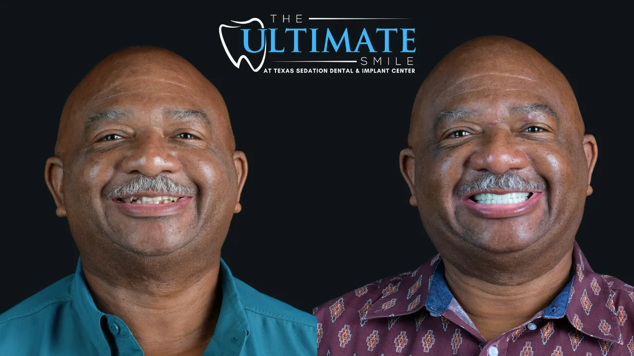 Real Texas Sedation Dental patient, before and after smile transformation