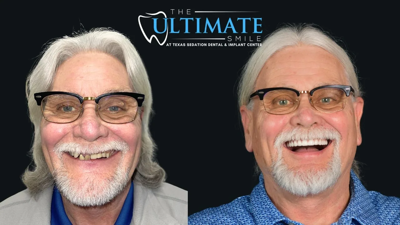 Real Texas Sedation Dental patient, before and after smile transformation