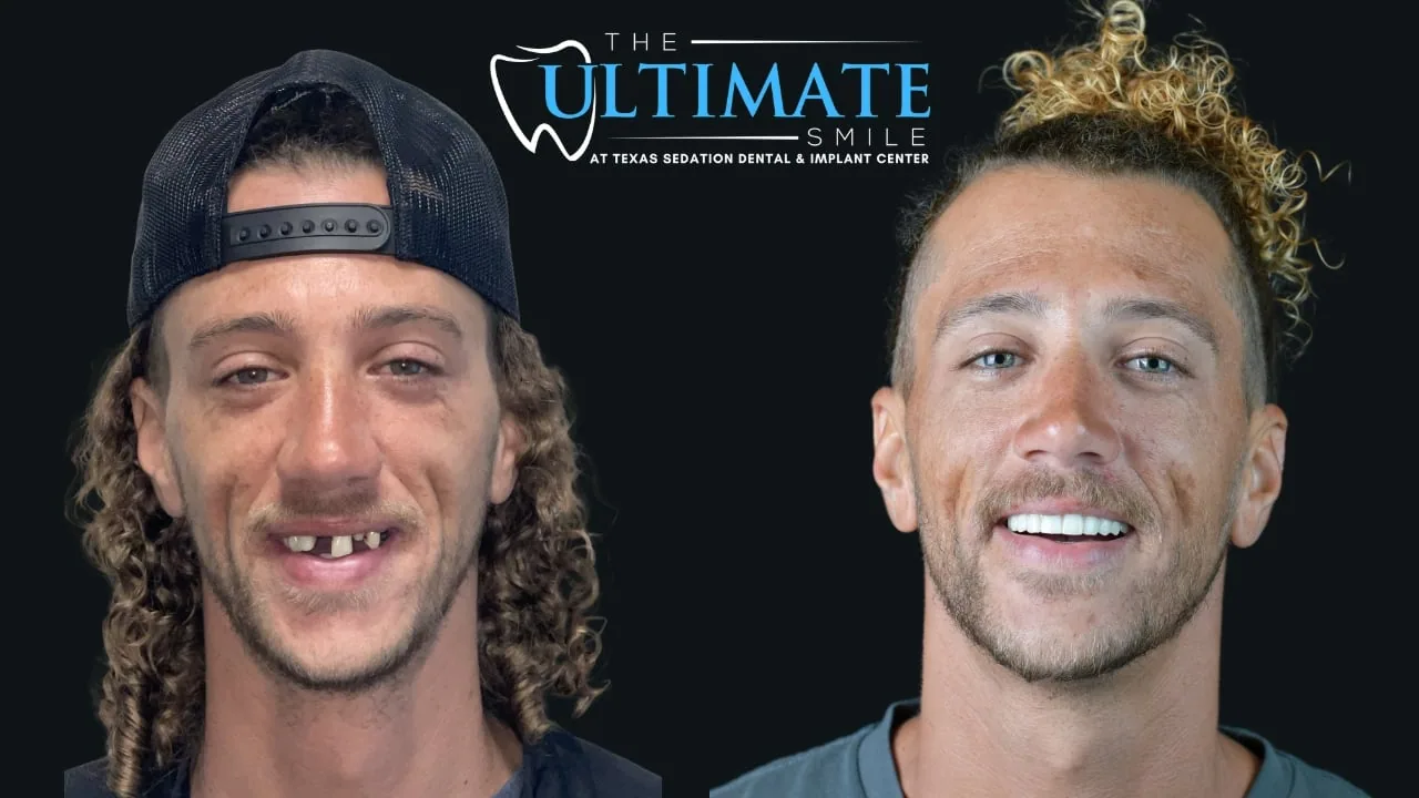 Real Texas Sedation Dental patient, before and after smile transformation