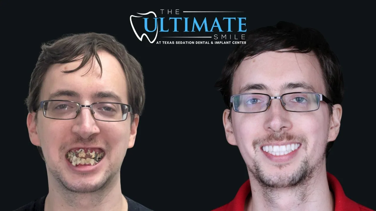 Real Texas Sedation Dental patient, before and after smile transformation
