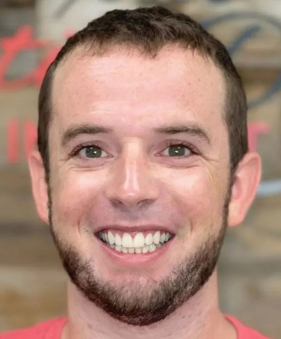 After: AI preview of the same full-face photo with a restored smile
