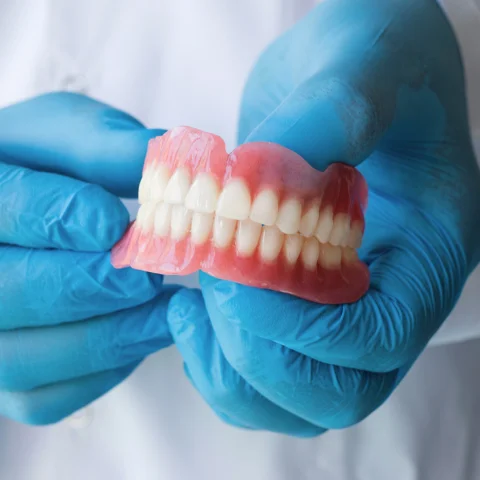 Dental professional holding full denture model with blue gloved hands