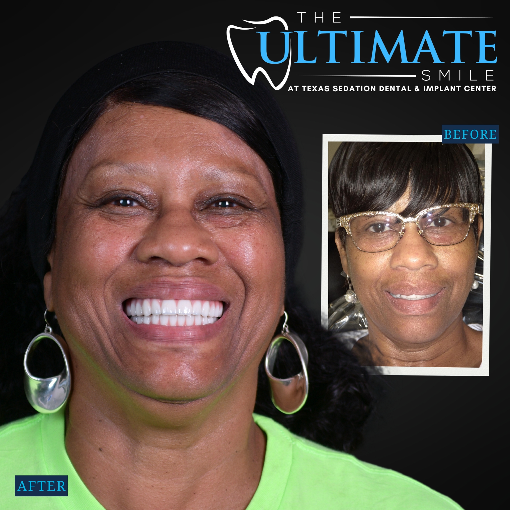Smiling patient after dental treatment with inset before photo showing broken teeth