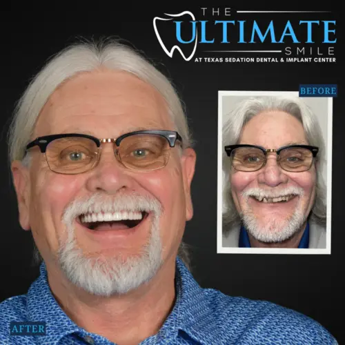 Smiling patient after dental treatment displayed beside smaller before smile photo