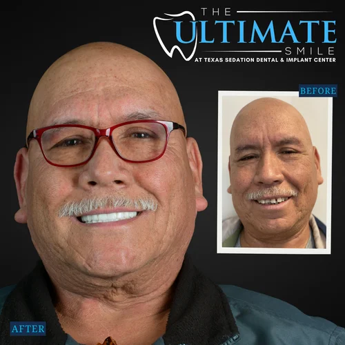 Smiling patient after dental treatment shown beside smaller before comparison photo