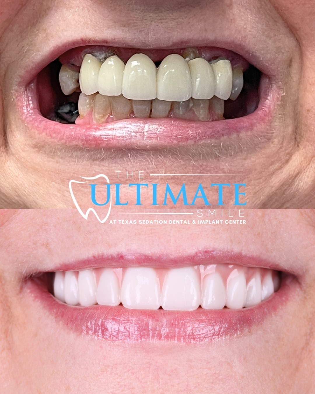 Upclose Smile B&As (2)