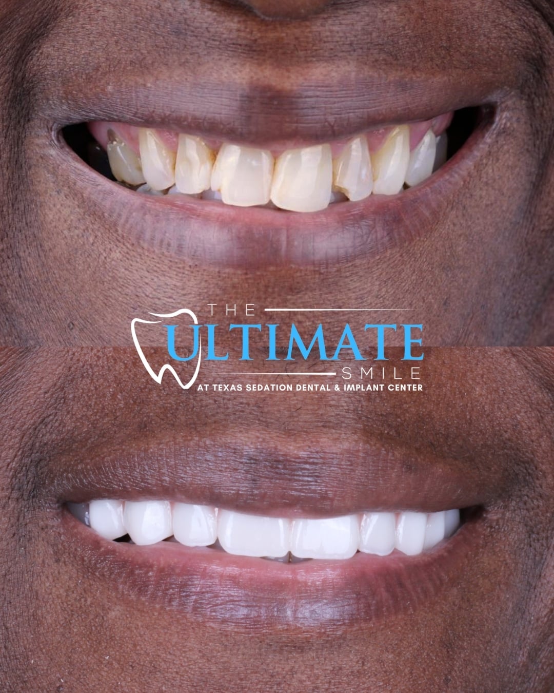 Upclose Smile B&As (4)