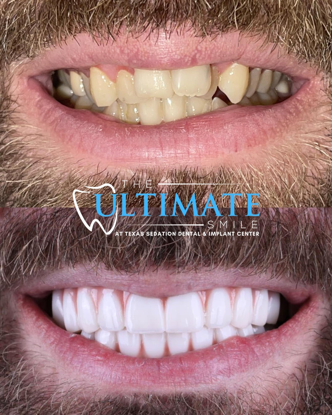 Upclose Smile B&As (5)