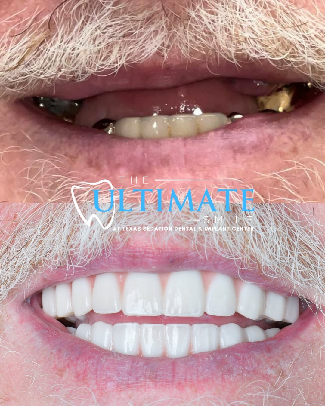 Upclose Smile B&As (6)